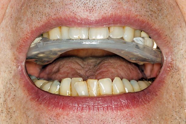 اقدامات دندانپزشکی
